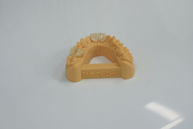 3D打印在口腔齿科领域都这么卷了吗？