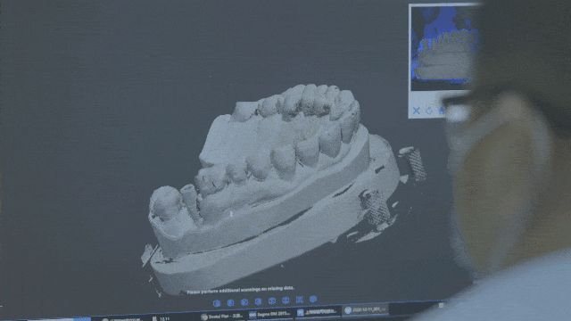 3D打印在口腔齿科领域都这么卷了吗？