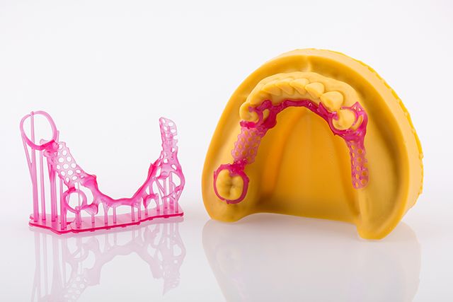 3D打印在口腔齿科领域都这么卷了吗？