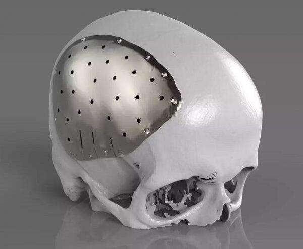 工业级金属3D打印设备